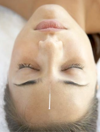 needle in the forehead